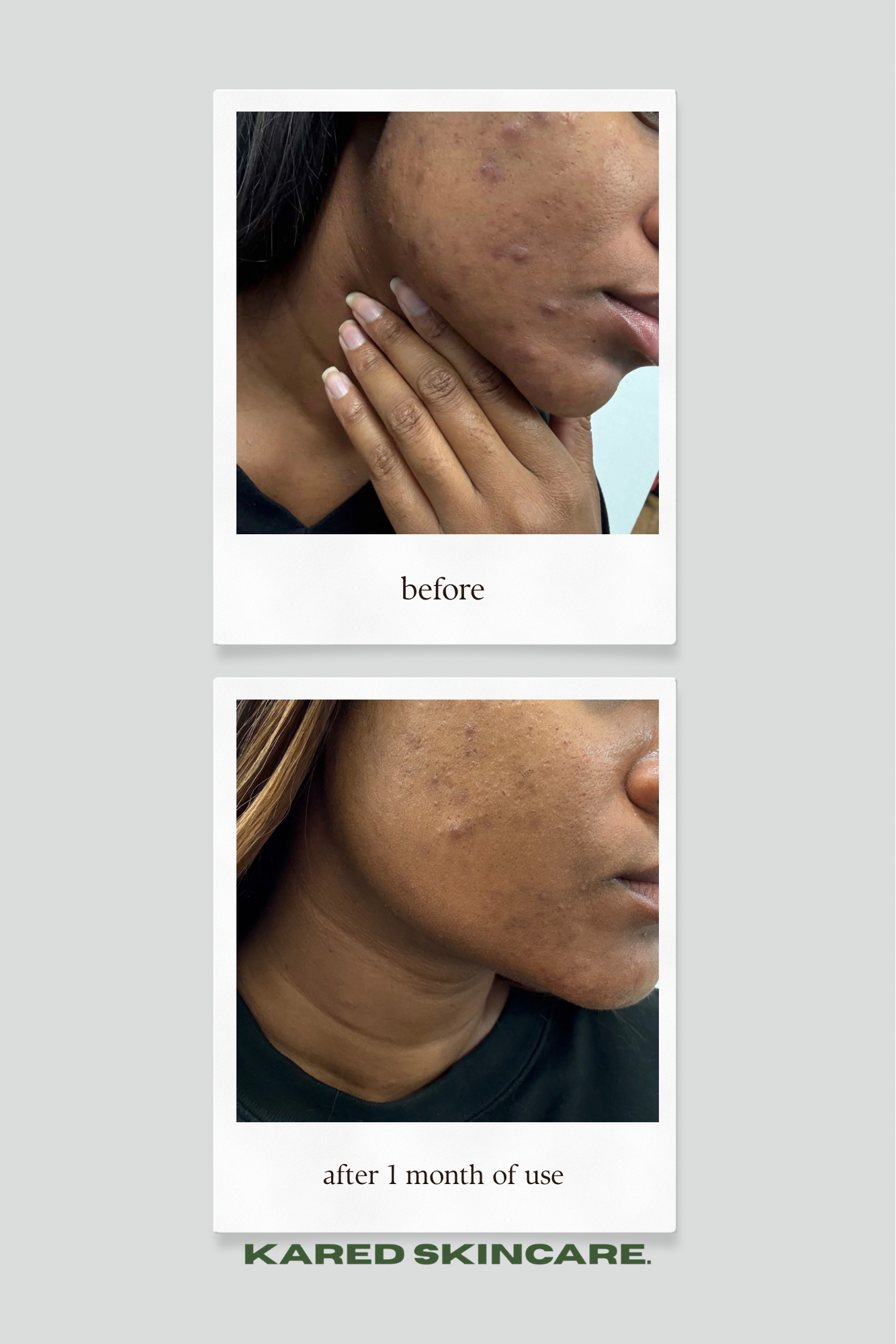 Turmeric Brightening Scrub